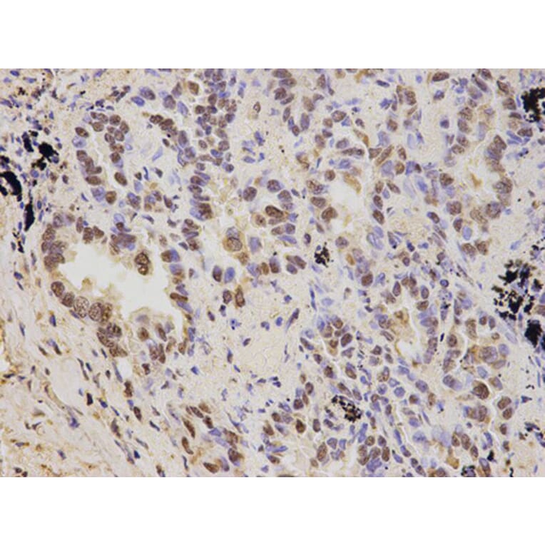 Immunohistochemistry - PSMD2 Antibody from Signalway Antibody (32544) - Antibodies.com