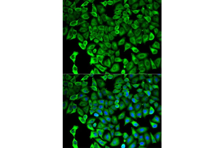 Immunofluorescence - PSMD2 Antibody from Signalway Antibody (32544) - Antibodies.com