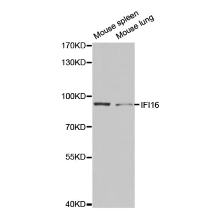 Western blot - IFI16 Antibody from Signalway Antibody (32549) - Antibodies.com