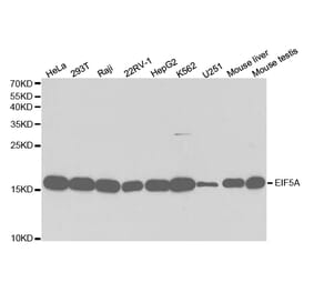 Western blot - EIF5A Antibody from Signalway Antibody (32552) - Antibodies.com