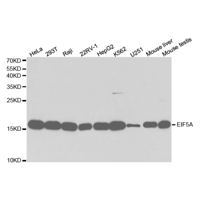 Western blot - EIF5A Antibody from Signalway Antibody (32552) - Antibodies.com