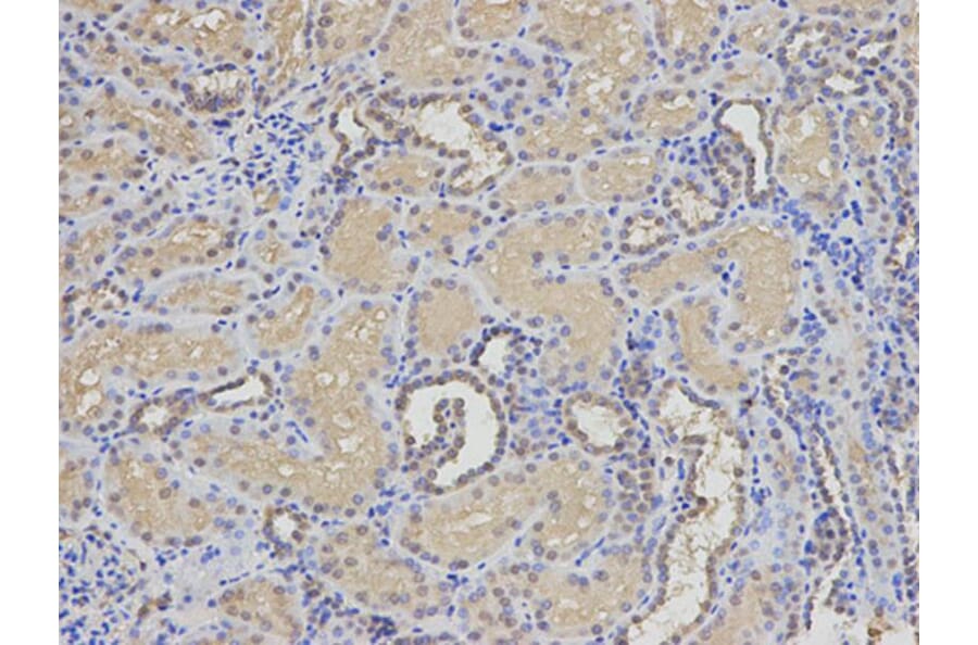 Immunohistochemistry - EIF5A Antibody from Signalway Antibody (32552) - Antibodies.com