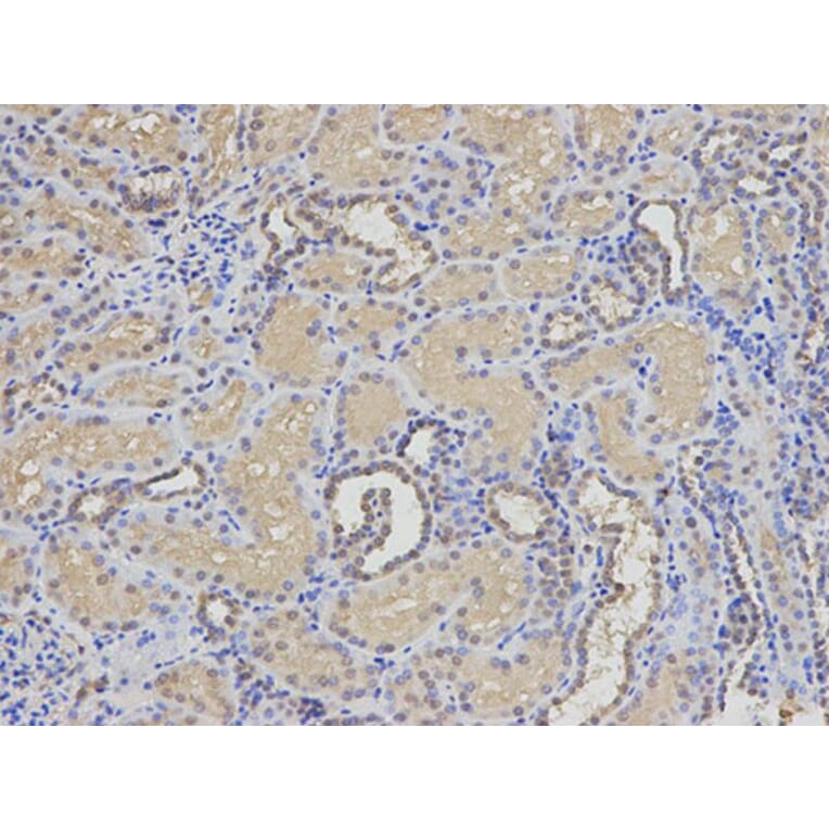 Immunohistochemistry - EIF5A Antibody from Signalway Antibody (32552) - Antibodies.com