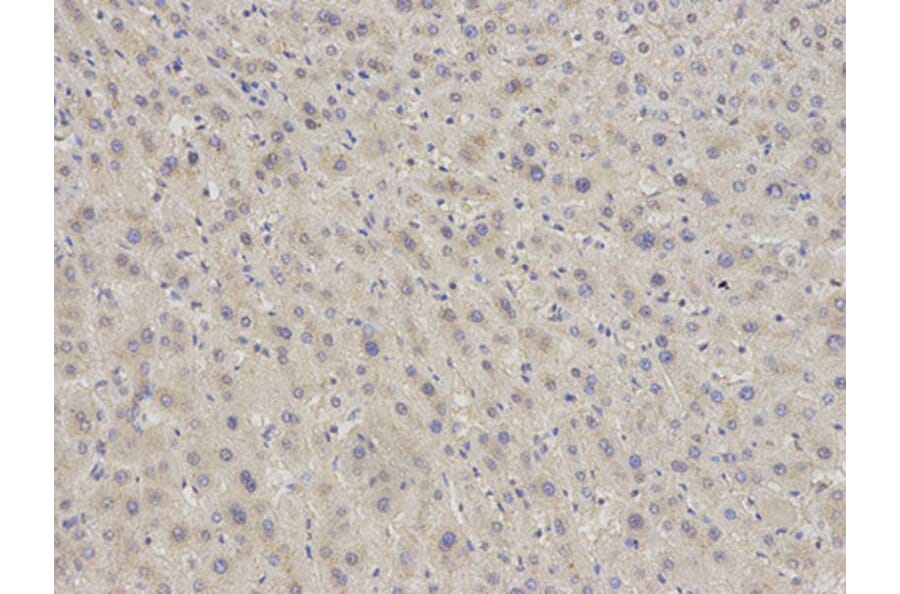 Immunohistochemistry - EIF5A Antibody from Signalway Antibody (32552) - Antibodies.com