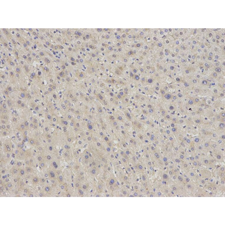 Immunohistochemistry - EIF5A Antibody from Signalway Antibody (32552) - Antibodies.com