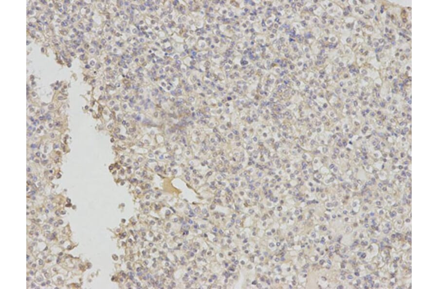 Immunohistochemistry - EIF5A Antibody from Signalway Antibody (32552) - Antibodies.com