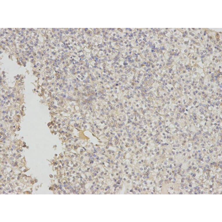 Immunohistochemistry - EIF5A Antibody from Signalway Antibody (32552) - Antibodies.com