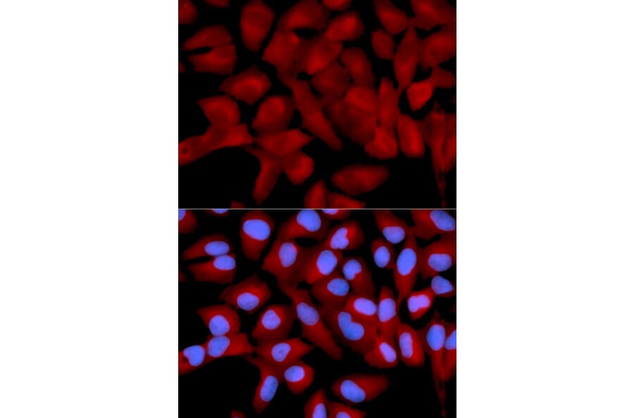Immunofluorescence - EIF5A Antibody from Signalway Antibody (32552) - Antibodies.com