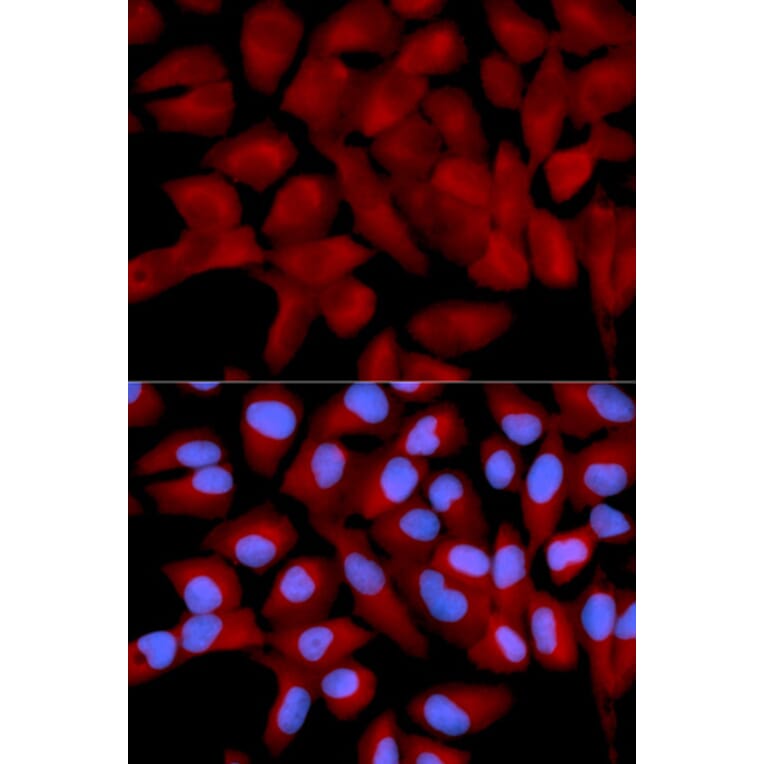 Immunofluorescence - EIF5A Antibody from Signalway Antibody (32552) - Antibodies.com