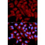 Immunofluorescence - EIF5A Antibody from Signalway Antibody (32552) - Antibodies.com