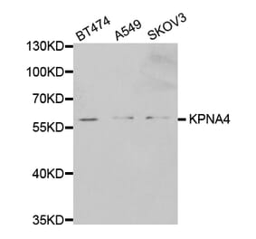 Western blot - KPNA4 Antibody from Signalway Antibody (32557) - Antibodies.com