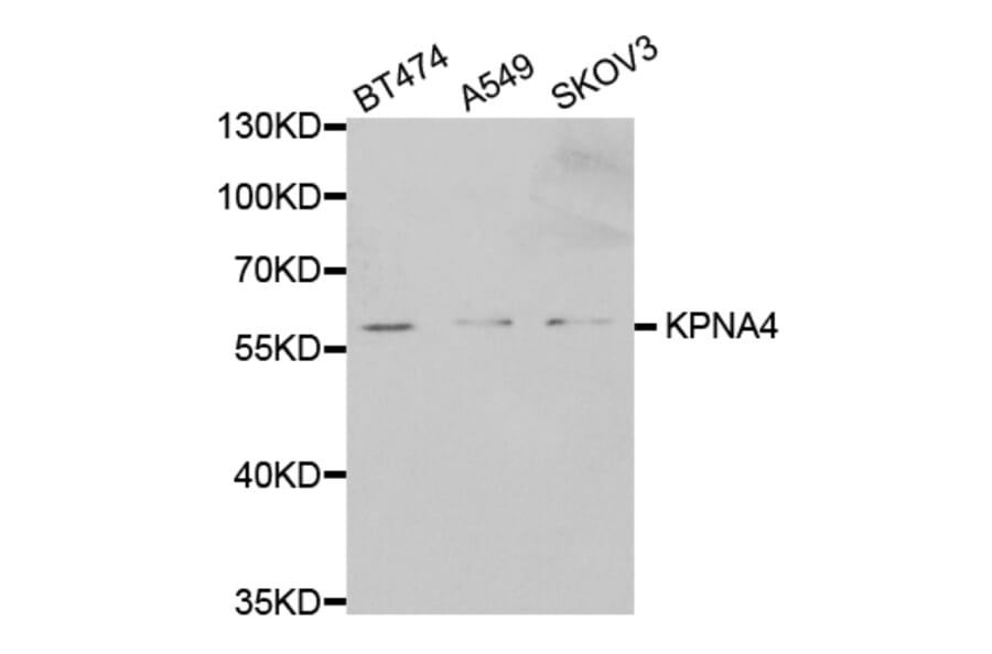 Western blot - KPNA4 Antibody from Signalway Antibody (32557) - Antibodies.com