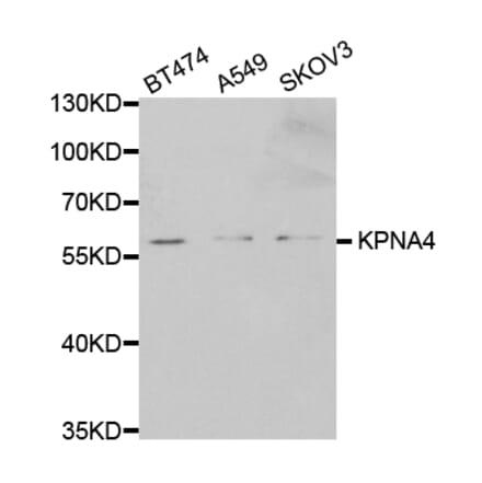 Western blot - KPNA4 Antibody from Signalway Antibody (32557) - Antibodies.com