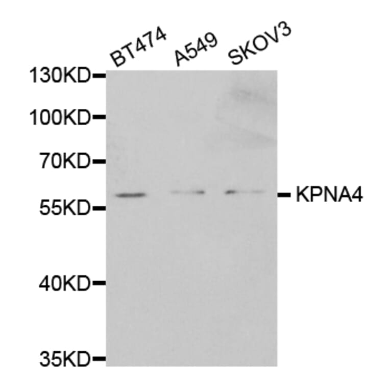 Western blot - KPNA4 Antibody from Signalway Antibody (32557) - Antibodies.com