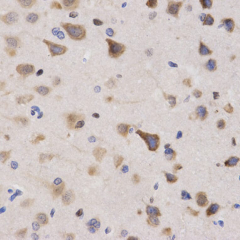 Immunohistochemistry - KPNA4 Antibody from Signalway Antibody (32557) - Antibodies.com