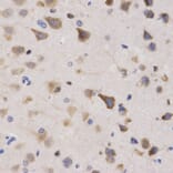 Immunohistochemistry - KPNA4 Antibody from Signalway Antibody (32557) - Antibodies.com