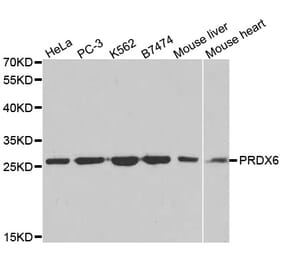 Western blot - PRDX6 Antibody from Signalway Antibody (32561) - Antibodies.com