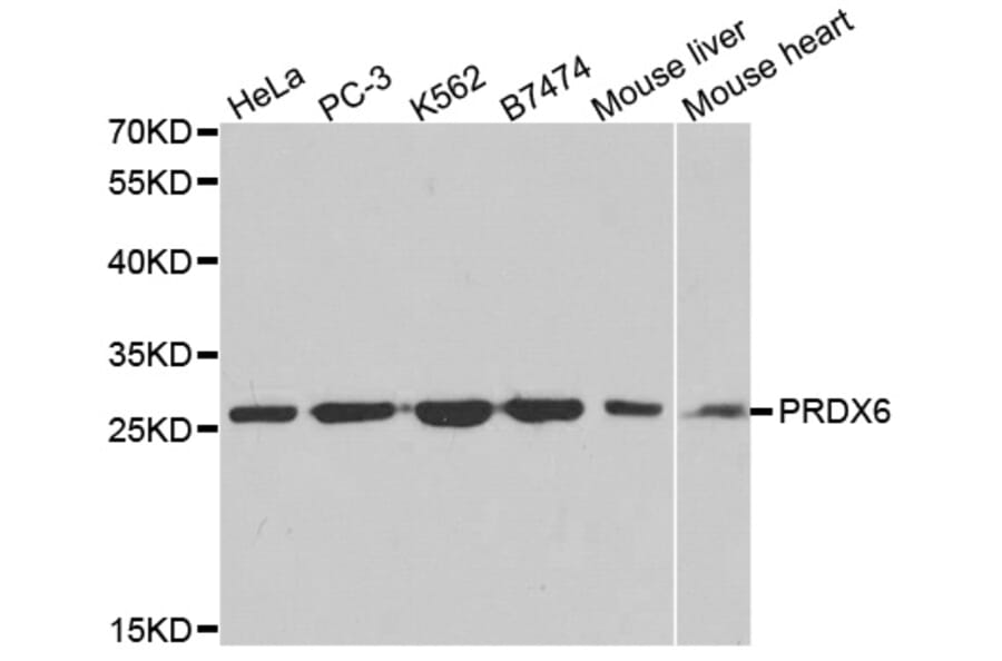 Western blot - PRDX6 Antibody from Signalway Antibody (32561) - Antibodies.com