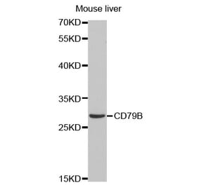 Western blot - CD79B Antibody from Signalway Antibody (32563) - Antibodies.com