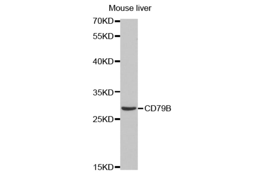 Western blot - CD79B Antibody from Signalway Antibody (32563) - Antibodies.com