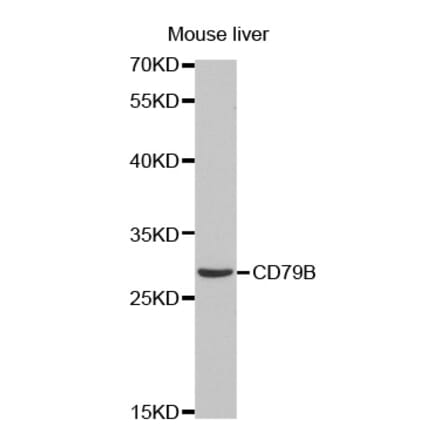 Western blot - CD79B Antibody from Signalway Antibody (32563) - Antibodies.com