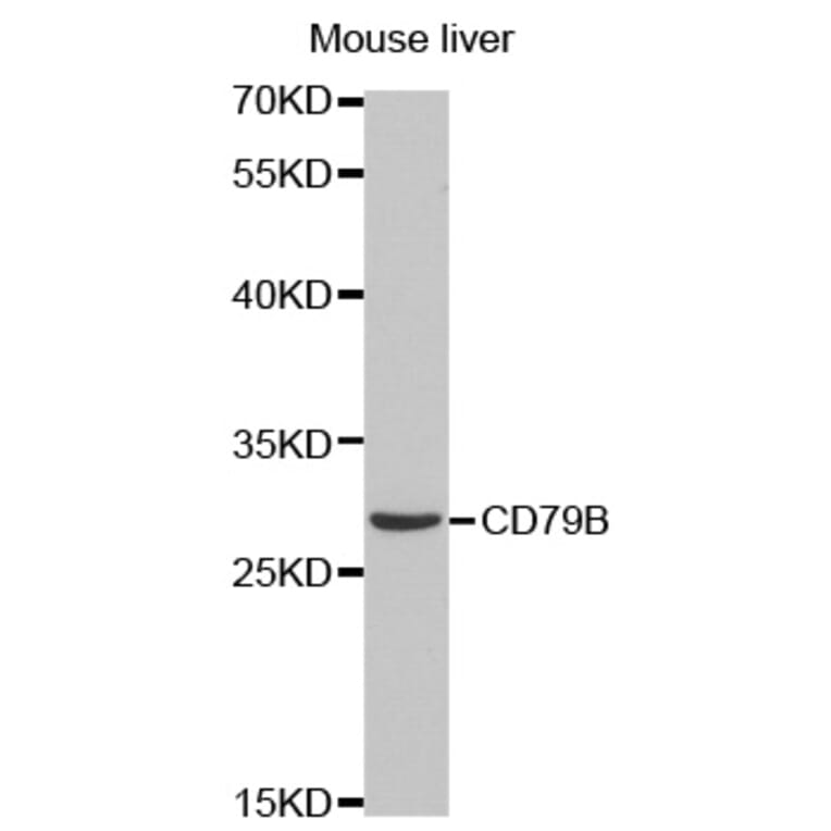 Western blot - CD79B Antibody from Signalway Antibody (32563) - Antibodies.com