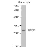 Western blot - CD79B Antibody from Signalway Antibody (32563) - Antibodies.com