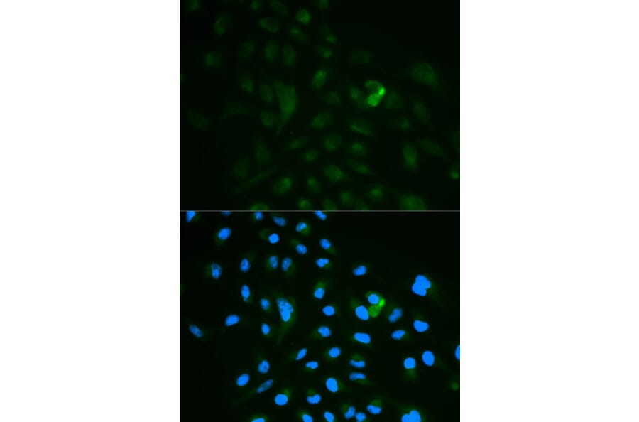 Immunofluorescence - CD79B Antibody from Signalway Antibody (32563) - Antibodies.com