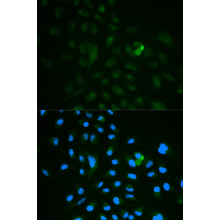 Immunofluorescence - CD79B Antibody from Signalway Antibody (32563) - Antibodies.com