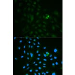 Immunofluorescence - CD79B Antibody from Signalway Antibody (32563) - Antibodies.com