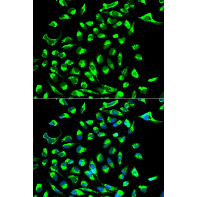 Immunofluorescence - CLDN7 Antibody from Signalway Antibody (32564) - Antibodies.com