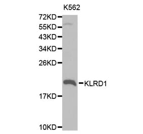 Western blot - KLRD1 Antibody from Signalway Antibody (32567) - Antibodies.com