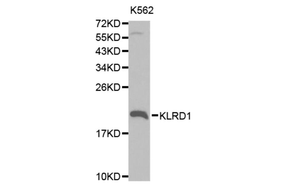 Western blot - KLRD1 Antibody from Signalway Antibody (32567) - Antibodies.com