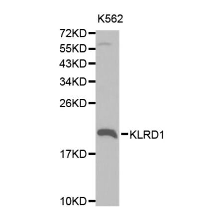 Western blot - KLRD1 Antibody from Signalway Antibody (32567) - Antibodies.com