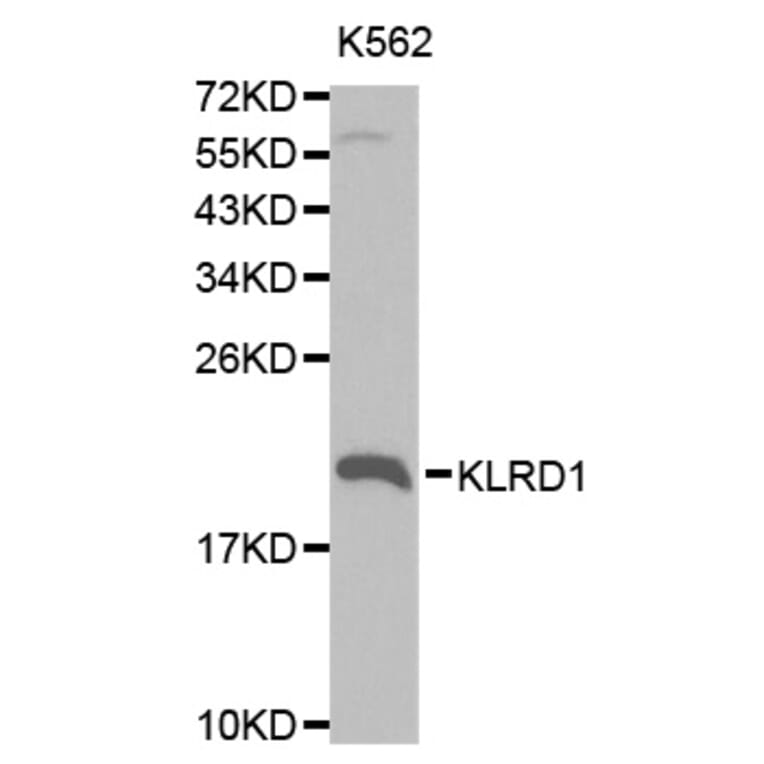 Western blot - KLRD1 Antibody from Signalway Antibody (32567) - Antibodies.com