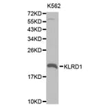 Western blot - KLRD1 Antibody from Signalway Antibody (32567) - Antibodies.com