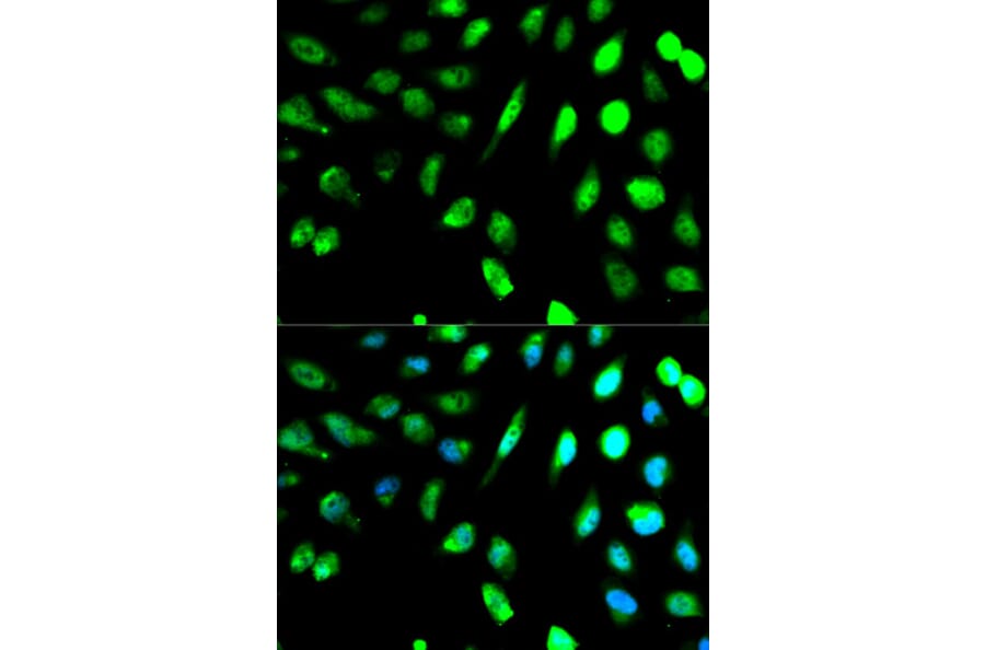 Immunofluorescence - KLRD1 Antibody from Signalway Antibody (32567) - Antibodies.com