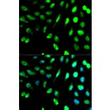 Immunofluorescence - KLRD1 Antibody from Signalway Antibody (32567) - Antibodies.com