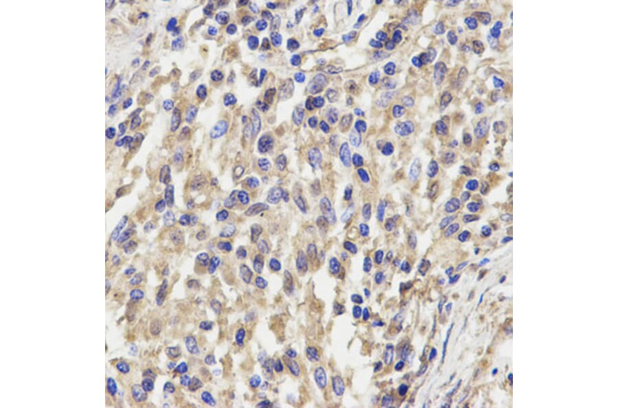 Immunohistochemistry - KLRD1 Antibody from Signalway Antibody (32567) - Antibodies.com