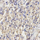 Immunohistochemistry - KLRD1 Antibody from Signalway Antibody (32567) - Antibodies.com