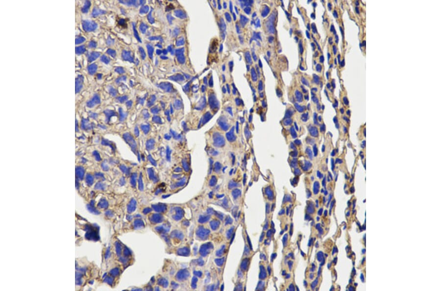 Immunohistochemistry - KLRD1 Antibody from Signalway Antibody (32567) - Antibodies.com
