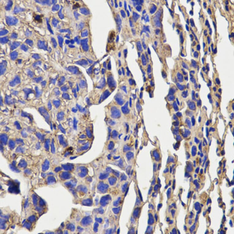 Immunohistochemistry - KLRD1 Antibody from Signalway Antibody (32567) - Antibodies.com