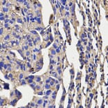 Immunohistochemistry - KLRD1 Antibody from Signalway Antibody (32567) - Antibodies.com