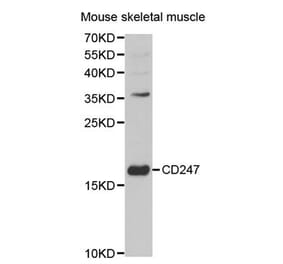 Western blot - CD247 Antibody from Signalway Antibody (32576) - Antibodies.com