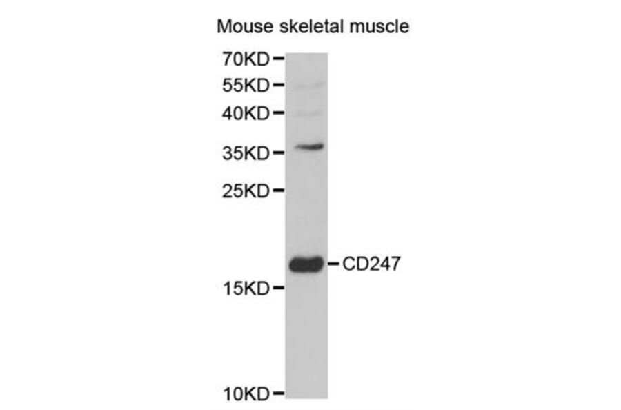 Western blot - CD247 Antibody from Signalway Antibody (32576) - Antibodies.com