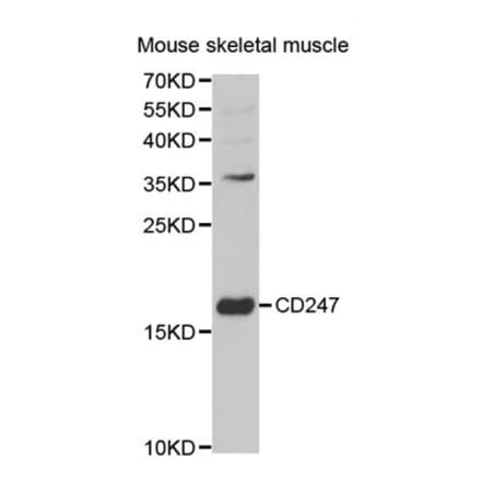 Western blot - CD247 Antibody from Signalway Antibody (32576) - Antibodies.com