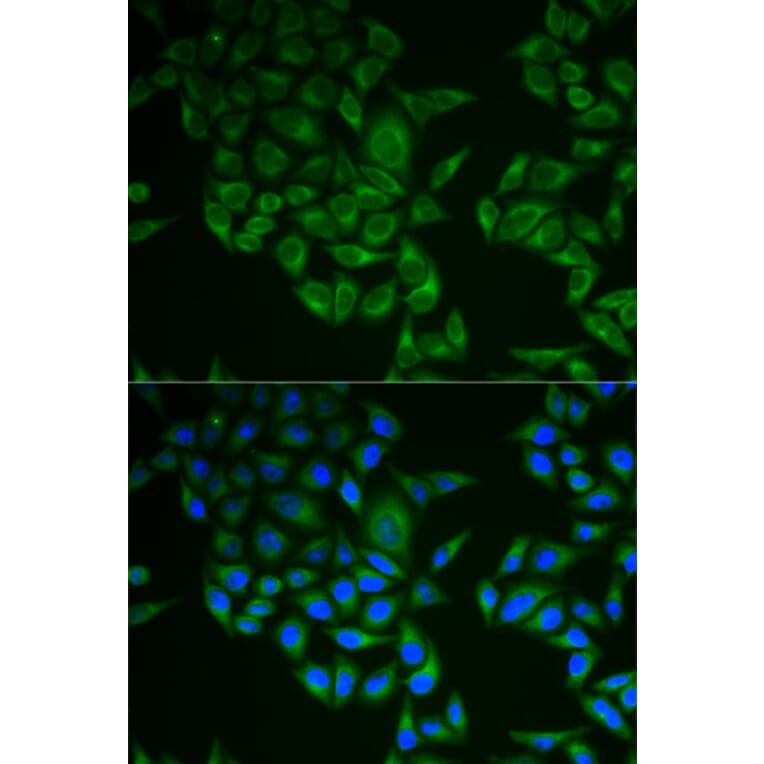 Immunofluorescence - CD247 Antibody from Signalway Antibody (32576) - Antibodies.com
