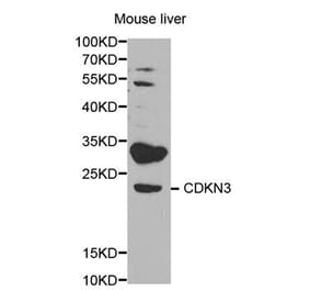 Western blot - CDKN3 Antibody from Signalway Antibody (32578) - Antibodies.com