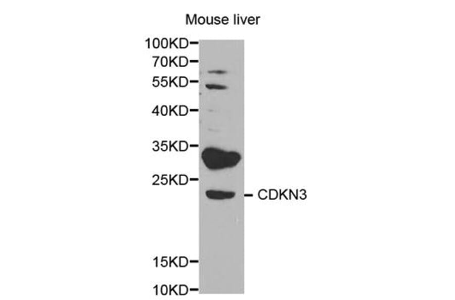Western blot - CDKN3 Antibody from Signalway Antibody (32578) - Antibodies.com