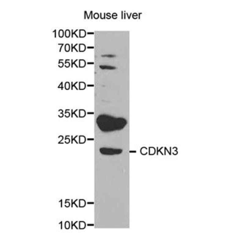 Western blot - CDKN3 Antibody from Signalway Antibody (32578) - Antibodies.com
